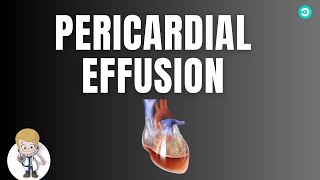 Pericardial Effusion sign and symptoms pathophysiology diagnosis amp treatment [upl. by Arukas]