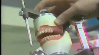 Posterior Teeth  Balanced Occlusion [upl. by Oriaj726]