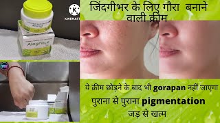 Demelan cream review  हिंदी में  Dr Aanchal Panth [upl. by Akerehs807]