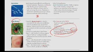 Spirochetes Lyme disease  Microbiology  24  First Aid USMLE in UrduHindi [upl. by Edra]