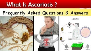 What is Ascariasis   Ascaris Lumbricoids Infections  FAQ [upl. by Spracklen399]