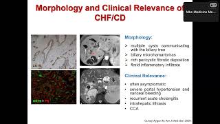Presentazione lavoro di ricerca  Dal fegato policistico al colangiocarcinoma [upl. by Mchale]