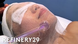 High Frequency Facial For Clear Skin  Beauty With Mi  Refinery29 [upl. by Nosae90]