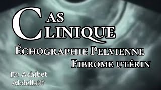 Dr Achibet  formation  Échographie pelvienne  fibrome utérin [upl. by Aivun]