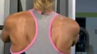 Shoulder Tendonitis Bursitis amp Impingement Syndrome  DePuy Videos [upl. by Munro576]