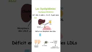 Retenez les Différentes Dyslipidémies sans Effort grâce à cette Méthode Mnémotechnique shorts [upl. by Aerdna948]