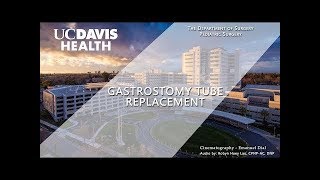 Gastrostomy Tube GTube Replacement Video  UC Davis Health [upl. by Yttig600]