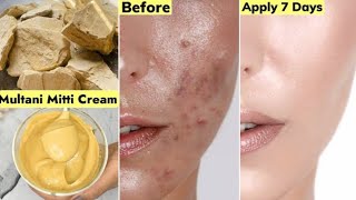 Indian👆Skin Whitening CreamBest Multani Matti Cream To Get Clear Smooth Glowing Skin [upl. by Eerrahs]