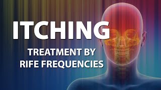 Itching Skin  RIFE Frequencies Treatment  Energy amp Quantum Medicine with Bioresonance [upl. by Einnaej574]