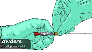 Gilupi  Neue Wege in der Krebsdiagnostik dank Nanomedizin [upl. by Treblih]