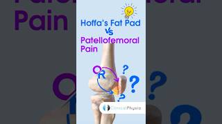 Hoffa’s Fat Pad vs Patellofemoral Pain physicaltherapy physiotheraphy kneepain [upl. by Ruthie622]