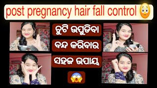 How to stop hairfall after DeliveryFemale hairloss treatmentPostpartum HairlossBest HairGrowtholi [upl. by Huff35]