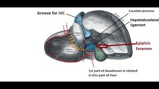 Epiploic foramen  easy and brief description [upl. by Hibbert]