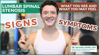 Lumbar Spinal Stenosis Pain Explained How To Start Feeling Better Now [upl. by Raddi]