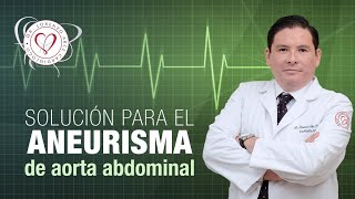 Solución para el Aneurisma de Aorta Abdominal [upl. by Blossom]