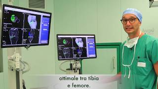 Protesi di Ginocchio con Robot RIO Makoplasty  Dott Enea [upl. by Cowey]