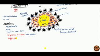 Tuberculosis for USMLE Step 1 and USMLE Step 2 [upl. by Sulihpoeht]