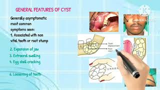 Cyst of orofacial region [upl. by Ilac244]