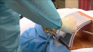 Chest tube insertion [upl. by Yrocaj113]