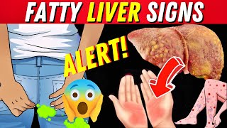 A Silent Threat 8 Clear Signs That Can Indicate Fatty Liver Disease [upl. by Divadnahtanoj]