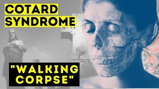 Cotard Syndrome  Walking Corpse Syndrome – What is it Short Documentary [upl. by Martinson318]