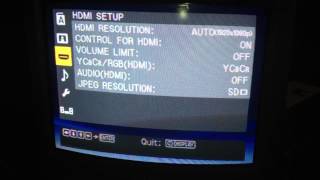 Adjust sound levels in Sony DAV170 Home Theater System [upl. by Siroved]