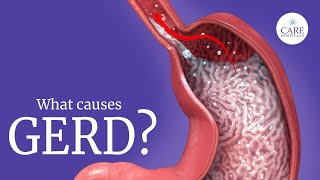 GERD  Gastroesophageal Reflux Disease GERD Causes Symptoms Treatment  Heart Burn  Acid Reflux [upl. by Llerraf58]