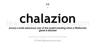 How to pronounce Chalazion  English pronunciation [upl. by Aifos]