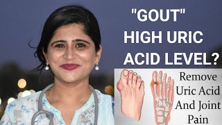 गठियाGout high uric acid levelhomoeopathic medicineयुरिक एसिड मात्रा कम करे होम्योपैथिक दवा से [upl. by Whelan]