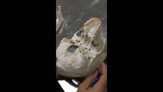 Practical osteology 5  skull  norma basalis externa  by Dr Wahdan [upl. by Eedia]