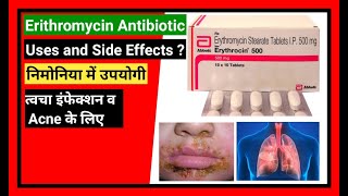 Erythromycin Tablet  Erythromycin Oral Suspension  Erythromycin 250 Uses [upl. by Barnie]