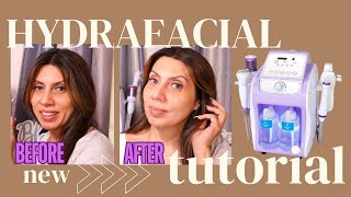 Honest Review  Mychway Hydro Dermabrasion Machine For Home Use Instant Glowing Skin HYDRAFACIAL [upl. by Atteuqahs]