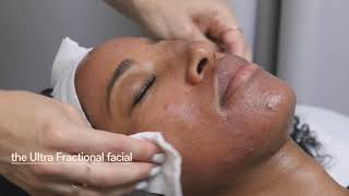 Skin Laundry Ultra Fractional facial [upl. by Tobin]