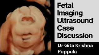 Fetal Imaging Ultrasound Spotter Cases with Dr Gita Krishna Puppala [upl. by Alhsa]