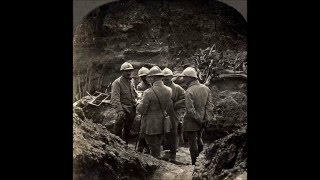 3D Stereoscopic Photographs of Trench Warfare During World War I Part 5 [upl. by Addie]