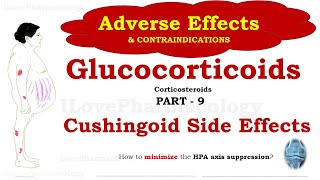 Glucocorticoids Adverse Effects Part 9  Corticosteroid Contraindications  Cushings Syndrome [upl. by Schlicher610]