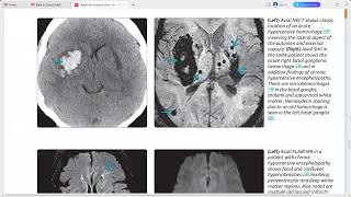 BRAIN DIAGNOSTIC IMAGING SERIES [upl. by Guido]