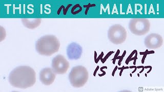 This is NOT Malaria What is it An Important Mimic of Plasmodium vivax Gametocyte on Blood Smear [upl. by Eineeuq784]