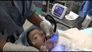 GlideScope Pediatric Airway Rounds Case Study 4 yearold Goldenhar Syndrome [upl. by Anuqahs908]