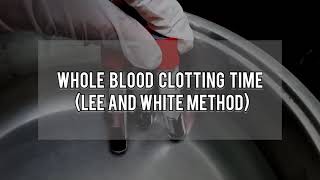 Blood Clotting Time Determination  How to Fill the Blood into Capillary  Blood Clotting Time [upl. by Jelene]