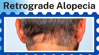 Hair Transplant in Patients with Retrograde Alopecia  Bitesize with Bisanga 42 [upl. by Arty]