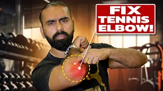 3 MustTry Workouts for Tennis Elbow Recovery  കൈമുട്ട് വേദന പെട്ടെന്ന്‌ മാറ്റാം [upl. by Hamrah]