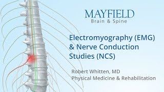 Electromyography EMG amp Nerve conduction studies NCS [upl. by Mcmillan440]