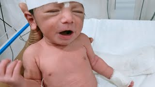 A NEWBORN ON THE CPAP MACHINE amp NEBULIZATION PROCEDURE   NICU   NEONATE CARE [upl. by Ettevram]