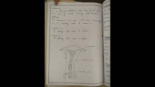 cervical cancer nursing care plan on cervical cancer NCP [upl. by Laro]