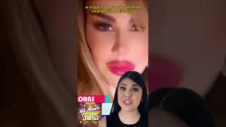 🔥😱¡NINEL CONDE IMPACTA con su NUEVO ROSTRO ¿Cirugías Extremas o Necesidad 😱¡NO CREERÁS el CAMBIO [upl. by Eissert584]