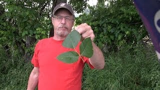 How to never have a serious poison ivy rash again [upl. by Trebla146]