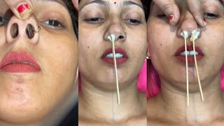 Nose hair waxingpiggynose nosepulling pummybeautyparlour pummybeautyworld [upl. by Nathanson]