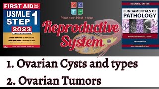 USMLE step1Ovarian cysts and Ovarian Tumors Part 1 from First AidReproductive PathologyUrduHindi [upl. by Ennaillek]