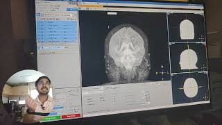 Venography MRI Contrast Explained MRVStep by Step on MRV plain as well as ContrastPart1 [upl. by Ermentrude]